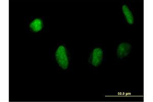 Immunofluorescence of purified MaxPab antibody to MSL3L1 on HeLa cell. (MSL3 Antikörper  (AA 1-521))