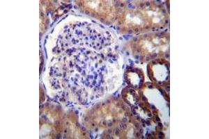 Immunohistochemistry analysis in formalin fixed and paraffin embedded human kidney tissue reacted with FUT6 Antibody (N-term) followed by peroxidase conjugation of the secondary antibody and DAB staining.