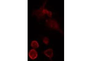 ABIN6275724 staining  HeLa cells by IF/ICC. (MED27 Antikörper  (Internal Region))