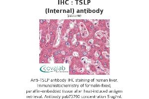 Image no. 2 for anti-Thymic Stromal Lymphopoietin (TSLP) (Internal Region) antibody (ABIN1740422) (Thymic Stromal Lymphopoietin Antikörper  (Internal Region))