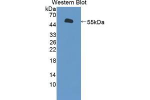 Western blot analysis of the recombinant protein. (BPIFA1 Antikörper  (AA 20-256))