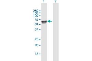 Western Blot analysis of UGT1A7 expression in transfected 293T cell line by UGT1A7 MaxPab polyclonal antibody.