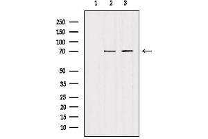 Western blot analysis of extracts from various samples, using HGFAC Antibody. (HGFA Antikörper  (C-Term))