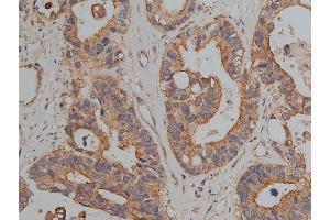 Immunohistochemistry (IHC) image for anti-Junction Plakoglobin (JUP) (C-Term) antibody (ABIN6260497)