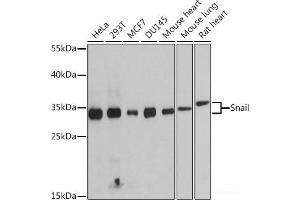 Western blot analysis of extracts of various cell lines using Snail Polyclonal Antibody at dilution of 1:1000. (SNAIL Antikörper)