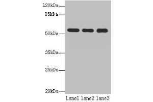 Western blot All lanes: TBC1D22A antibody at 18 μg/mL Lane 1: Colo320 whole cell lysate Lane 2: HepG2 whole cell lysate Lane 3: Rat skeletal muscle tissue Secondary Goat polyclonal to rabbit IgG at 1/10000 dilution Predicted band size: 60, 51, 37, 54 kDa Observed band size: 60 kDa (TBC1D22A Antikörper  (AA 1-280))
