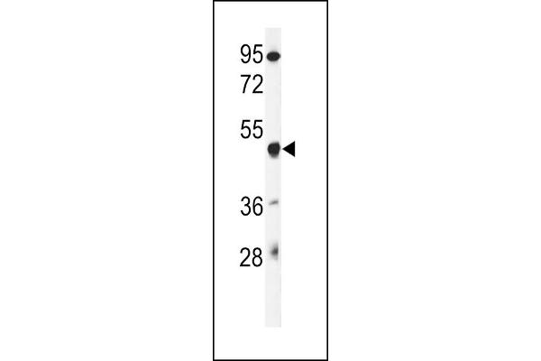 Gasdermin A anticorps  (N-Term)