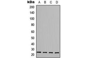 Western blot analysis of FGF6 expression in MCF7 (A), HepG2 (B), Raw264. (FGF6 Antikörper  (C-Term))