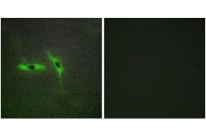 Immunofluorescence analysis of HepG2 cells, using TNFRSF6B Antibody. (TNFRSF6B Antikörper  (AA 251-300))