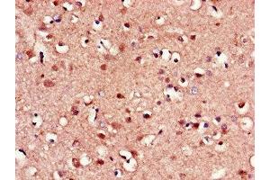 Immunohistochemistry of paraffin-embedded human brain tissue using ABIN7153193 at dilution of 1:100 (FZD8 Antikörper  (AA 55-233))
