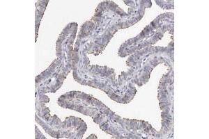Immunohistochemical staining of human fallopian tube with KIF26B polyclonal antibody  shows distinct positivity in ciliated cells at 1:50-1:200 dilution. (KIF26B Antikörper)