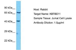 Host: Rabbit Target Name: KBTBD11 Sample Type: Jurkat Whole Cell lysates Antibody Dilution: 1. (KBTBD11 Antikörper  (Middle Region))