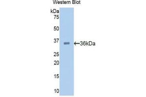 Western blot analysis of the recombinant protein. (PCSK9 Antikörper  (AA 156-461))
