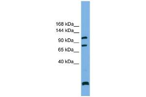 WB Suggested Anti-PPP6R1  Antibody Titration: 0. (SAPS1 Antikörper  (N-Term))