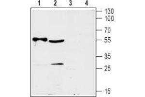 Western blot analysis of rat heart (lanes 1 and 3) and mouse brain (lanes 2 and 4) lysates:  - 1,2. (SLC29A2 Antikörper  (3rd Intracellular Loop))