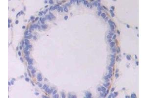 Immunohistochemistry (IHC) image for anti-Endoglin (ENG) (AA 26-136) antibody (ABIN7432976)