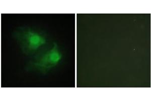 Immunofluorescence analysis of HeLa cells, using LIMK2 antibody. (LIMK2 Antikörper  (Internal Region))
