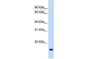 WB Suggested Anti-Rgs2 Antibody Titration:  1. (RGS2 Antikörper  (Middle Region))
