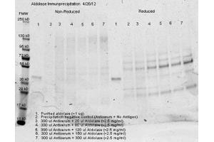 Anti aldolase antibody– Immunoprecipitation- Immunoprecipitation was performed with 300 ul of anti aldolase antiserum and an equal volume of varied amounts (diluted from a stock solution of ~2.