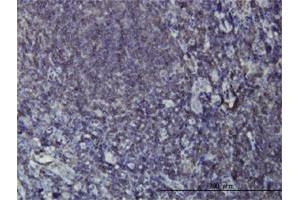 Immunoperoxidase of monoclonal antibody to EPHB3 on formalin-fixed paraffin-embedded human tonsil. (EPH Receptor B3 Antikörper  (AA 899-997))