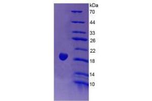 Image no. 1 for Endothelin 1 (EDN1) (AA 54-202) (Active) protein (His tag) (ABIN6239857) (Endothelin 1 Protein (EDN1) (AA 54-202) (His tag))