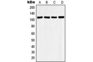 Western blot analysis of Histone Deacetylase 9 expression in LO2 (A), mouse heart (B), rat heart (C), Ramos (D) whole cell lysates.