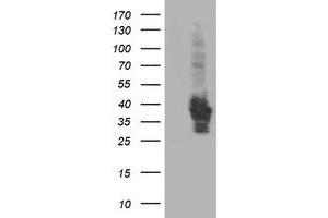 Western Blotting (WB) image for anti-HSPA Binding Protein, Cytoplasmic Cochaperone 1 (HSPBP1) antibody (ABIN1498757) (HSPBP1 Antikörper)