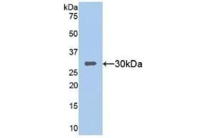 Detection of Recombinant SIRT1, Mouse using Polyclonal Antibody to Sirtuin 1 (SIRT1) (SIRT1 Antikörper  (AA 236-490))