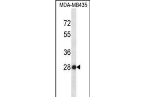 SNRPB2 Antibody (N-term) (ABIN656315 and ABIN2845618) western blot analysis in MDA-M cell line lysates (35 μg/lane). (SNRPB2 Antikörper  (N-Term))