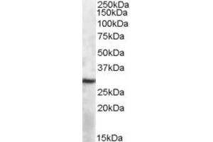 ABIN334347 (1µg/ml) staining of Mouse Spleen lysate (35µg protein in RIPA buffer). (APOBEC1 Antikörper  (Internal Region))