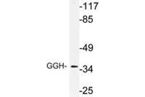 Western blot (WB) analysis of GGH antibody in extracts from RAW264.