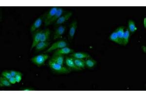 Immunofluorescent analysis of Hela cells using ABIN7156336 at dilution of 1:100 and Alexa Fluor 488-congugated AffiniPure Goat Anti-Rabbit IgG(H+L) (IRS2 Antikörper  (AA 766-1001))