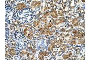 Cystatin B antibody was used for immunohistochemistry at a concentration of 4-8 ug/ml. (CSTB Antikörper)