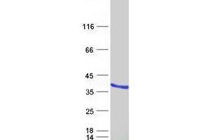 Validation with Western Blot (UNC119 Protein (Transcript Variant 1) (Myc-DYKDDDDK Tag))