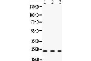 Anti-GST3/GST pi antibody,Western blotting All lanes: Anti GST3/GST pi  at 0.