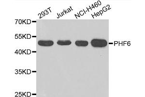Western blot analysis of extracts of various cell lines, using PHF6 antibody (ABIN4904747) at 1:1000 dilution. (PHF6 Antikörper)
