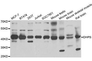 Western blot analysis of extracts of various cell lines, using DHPS antibody. (DHPS Antikörper  (AA 1-369))