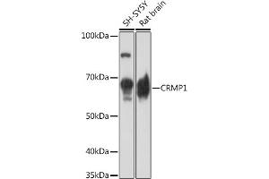 Western blot analysis of extracts of various cell lines, using CRMP1 Rabbit mAb (ABIN7266468) at 1:1000 dilution. (CRMP1 Antikörper)