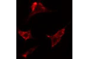 ABIN6274187 staining HepG2 cells by IF/ICC. (ADRA2C Antikörper  (Internal Region))