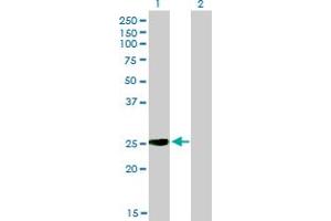 Western Blot analysis of IGSF6 expression in transfected 293T cell line by IGSF6 monoclonal antibody (M01), clone 2A12.