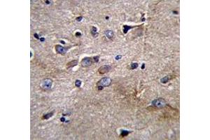 Immunohistochemistry (Paraffin-embedded Sections) (IHC (p)) image for anti-Nuclear Factor of kappa Light Polypeptide Gene Enhancer in B-Cells Inhibitor-Like 1 (NFKBIL1) (AA 334-364), (C-Term) antibody (ABIN953696)