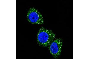 Confocal immunofluorescent analysis of MEN1 Antibody  (ABIN391614 and ABIN2841535) with Hela cell followed by Alexa Fluor 488-conjugated goat anti-rabbit lgG (green). (Menin Antikörper  (AA 584-615))