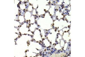 Immunohistochemistry of paraffin-embedded mouse lung using CBX5 antibody. (CBX5 Antikörper  (AA 1-100))