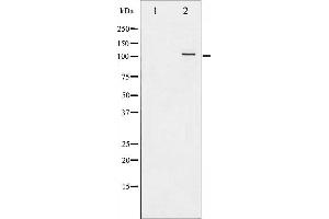 Western Blotting (WB) image for anti-Nuclear Factor of kappa Light Polypeptide Gene Enhancer in B-Cells 1 (NFKB1) (pSer907) antibody (ABIN6255562)
