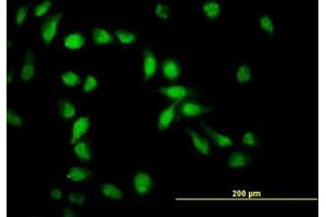 Image no. 4 for anti-Apoptosis Inhibitor 5 (API5) (AA 400-504) antibody (ABIN466131) (Apoptosis Inhibitor 5 Antikörper  (AA 400-504))