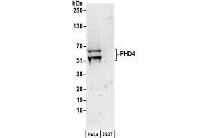 Western Blotting (WB) image for anti-Prolyl 4-Hydroxylase, Transmembrane (Endoplasmic Reticulum) (P4HTM) (C-Term) antibody (ABIN7449275)