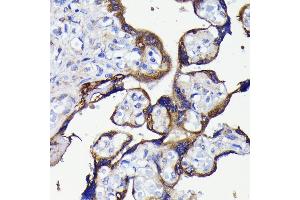 Immunohistochemistry of paraffin-embedded human placenta using  antibody (ABIN7265710) at dilution of 1:100 (40x lens). (ATG5 Antikörper)