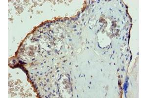 Immunohistochemistry of paraffin-embedded human placenta tissue using ABIN7147242 at dilution of 1:100 (PGS1 Antikörper  (AA 110-400))