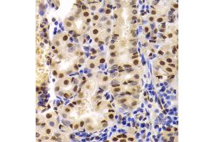 Immunohistochemistry of paraffin-embedded Human gastric using XRCC5 antibody at dilution of 1:100 (40x lens).