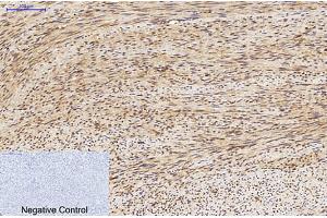 Immunohistochemical analysis of paraffin-embedded human uterus tissue. (MAP1LC3A Antikörper)
